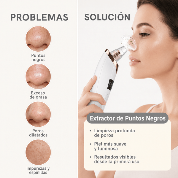 Extractor De Puntos Negros